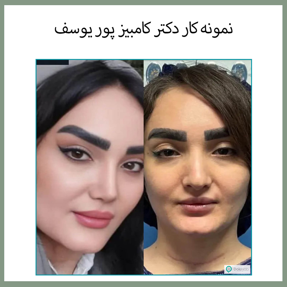 دکتر کامبیز پور یوسف