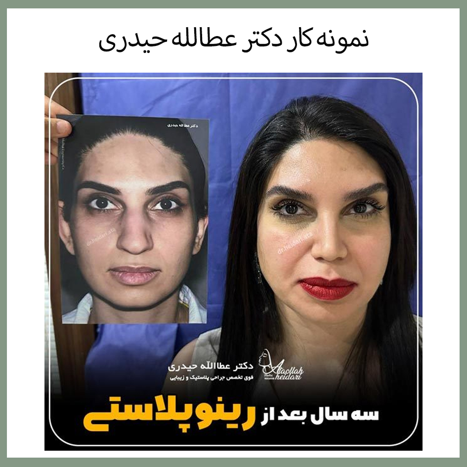 نمونه کار دکتر عطالله حیدری
