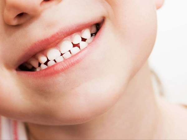 دلایل تاخیر در رویش دندان دائمی