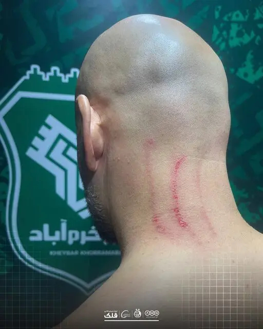 واکنش باشگاه‌های استقلال و خیبر به اتفاقات بازی امروز