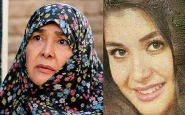 آفرین عبیسی قبل از عمل بینی