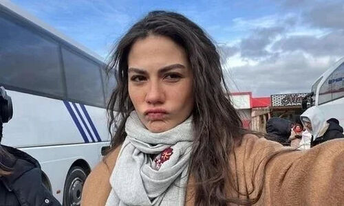 دمت اوزدمیر بدون آرایش؛ زیبایی واقعی بازیگر محبوب ترک که همه را شگفت‌زده کرد!
