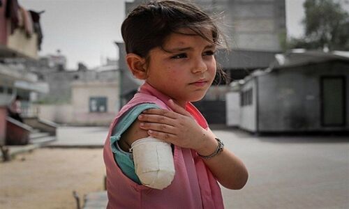 هشدار شدید یونیسف درباره جان ۱۱ هزار کودک زخمی و معلول در غزه؛ بحران انسانی بی‌سابقه!