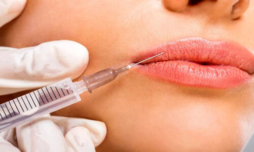 موج بازگشت به لب‌های طبیعی؛ چرا مردم ژل‌های لب را تخلیه می‌کنند؟