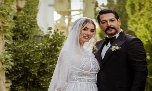 سفر زمان با متین ستوده؛ نگاهی متفاوت به عکس‌های پیش از عمل زیبایی