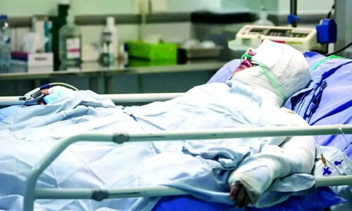 چرا ایرانی‌ها ۸ برابر بیشتر از جهان در معرض سوختگی وحشتناک هستند؟