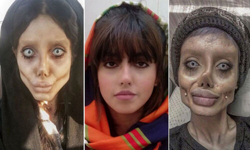 بیوگرافی و زندگی شخصی سحر تبر + عکس های قبل از عمل