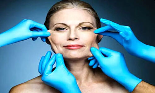 لیفت صورت بدون جراحی با چه روش‌هایی انجام می‌شود؟ + معرفی ۱۶ روش مختلف