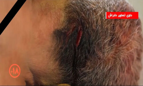 فیلم معاینه دقیق اجساد کشته شدگان ناآرامی های تهران توسط کارشناس پزشکی قانونی / حاوی صحنه های دلخراش