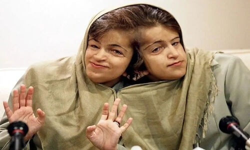قصه زندگی لاله و لادن; خواهرانی با دو مغز و یک قلب+ عکس مزار